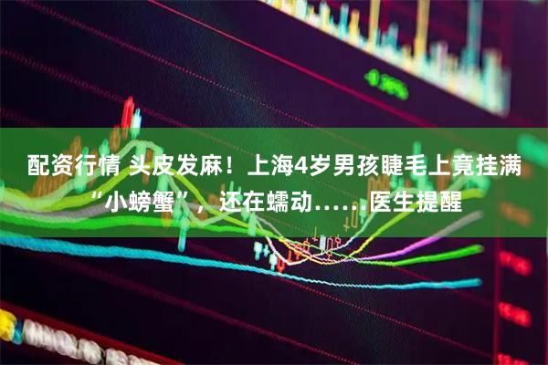 配资行情 头皮发麻！上海4岁男孩睫毛上竟挂满“小螃蟹”，还在蠕动……医生提醒